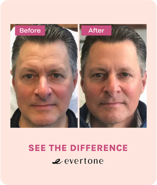 Microcurrent Facial Toning Device/EverLift