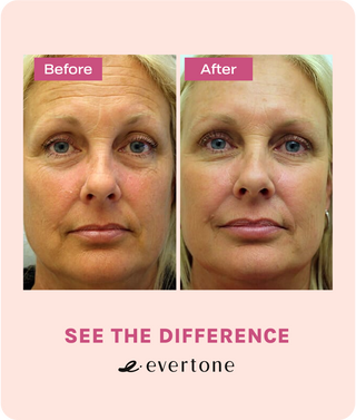 Microcurrent Facial Toning Device/EverLift
