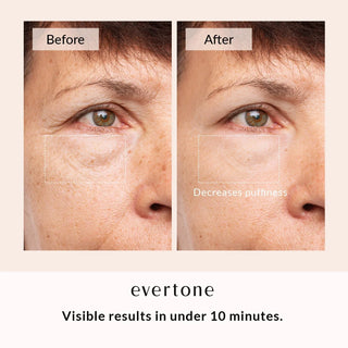Undereye Patches