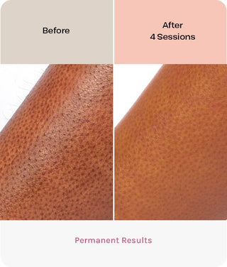 EVERSMOOTH - Evertone Skin