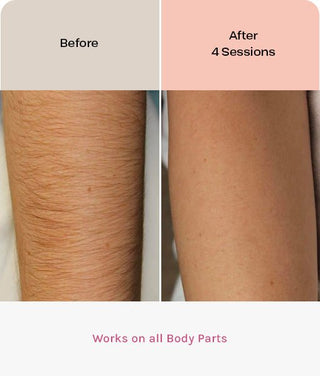 EVERSMOOTH - Evertone Skin