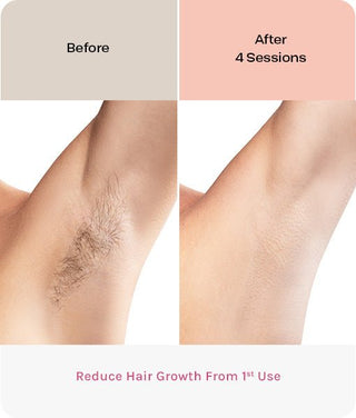 EVERSMOOTH - Evertone Skin