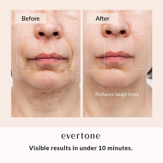 SKIN REJUVENATION BUNDLE - Evertone Skin